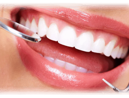 Deep Cleaning: Your Shield Against Gum Disease