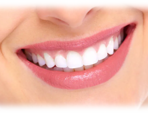 Transform Your Smile with Gingival Contouring