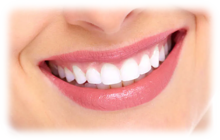full_mouth A woman smiling broadly with well contoured gums.