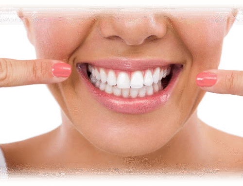 Smile Bright on Vacation with Teeth Whitening