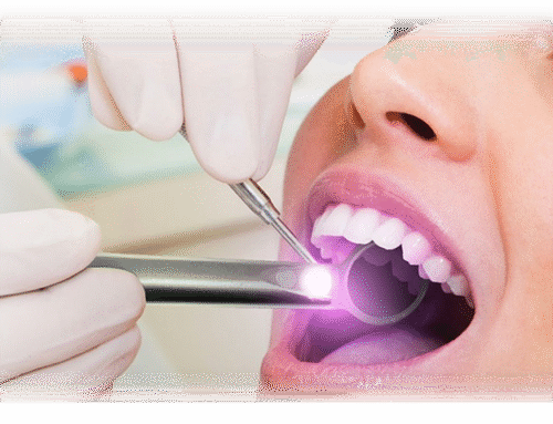 Gum Trouble in Disguise: Know the Signs Early