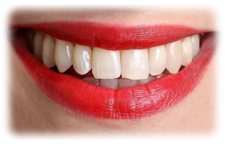smile_makeover