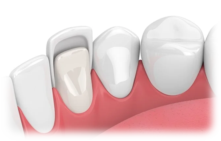 Dentures & Partials Gum Grafting in Stuart Florida