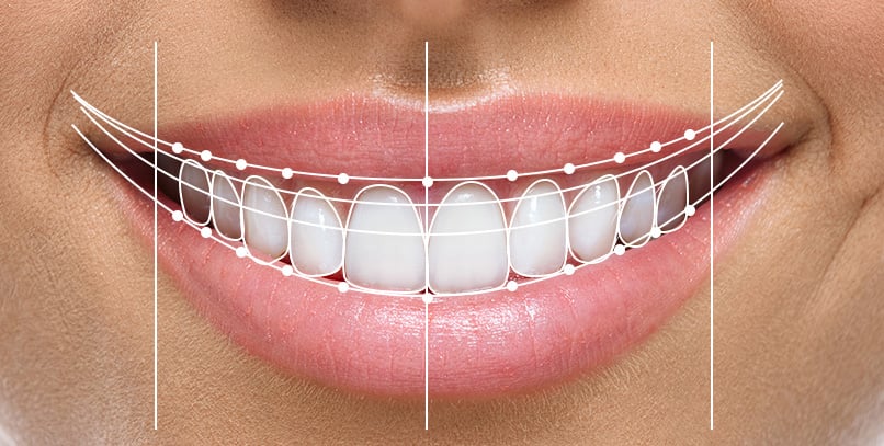 teeth-diagram