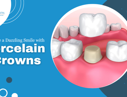 Porcelain crowns in miami