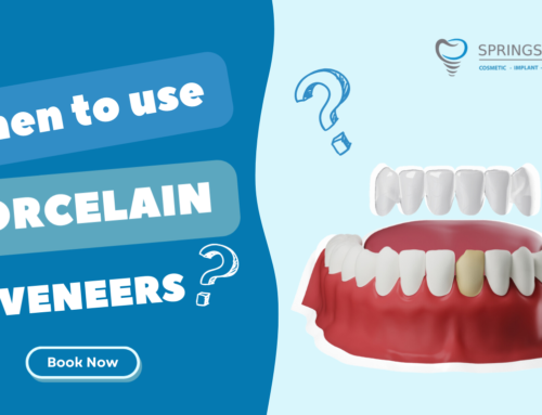 When to use Porcelain Veneers in Miami