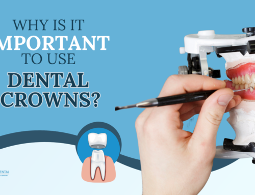 Why is it Important to use Dental Crowns? in Miami Springs, FL