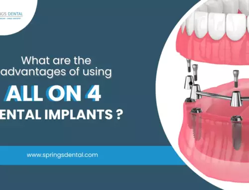 What are the advantages of using All on 4 Dental Implants? in Miami Springs, FL