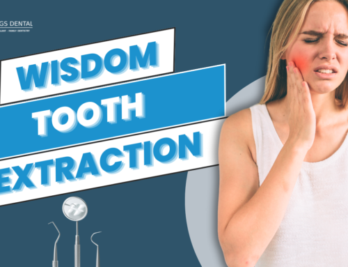 Wisdom tooth extraction in Miami Springs, FL