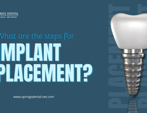 Implant placement in Miami Springs, FL