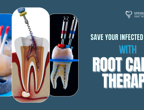 Root Canal in Miami Springs, FL