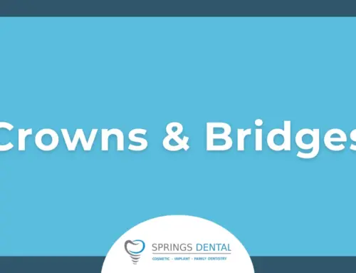 Crowns and Bridges: How They Work and What They’re Used For in Miami Springs, FL