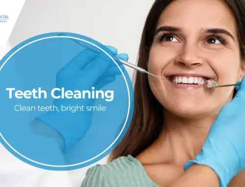 Comprehensive Guide to Teeth Cleaning and What You Need to Know in Miami Springs, FL